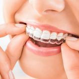 Bij Tandheelkunde Goudsesingel kun je je tanden laten bleken